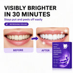 Purple Teeth Whitening Strips